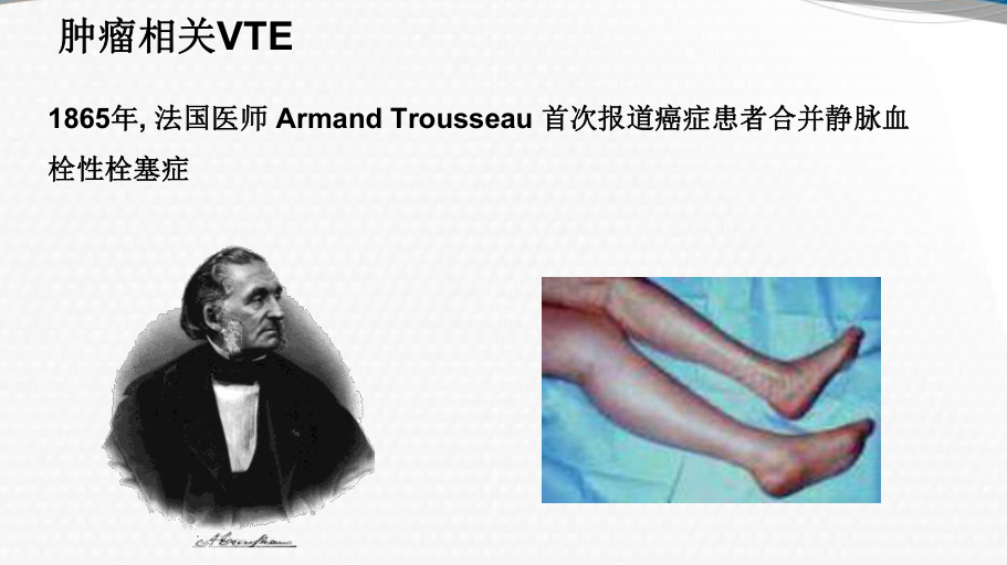 腫瘤相關(guān)VTE的特點及處理要點