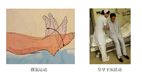圍術(shù)期患者VTE的預(yù)防，只知道抗凝可不行
