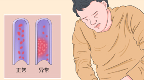 VTE的危害您了解嗎？