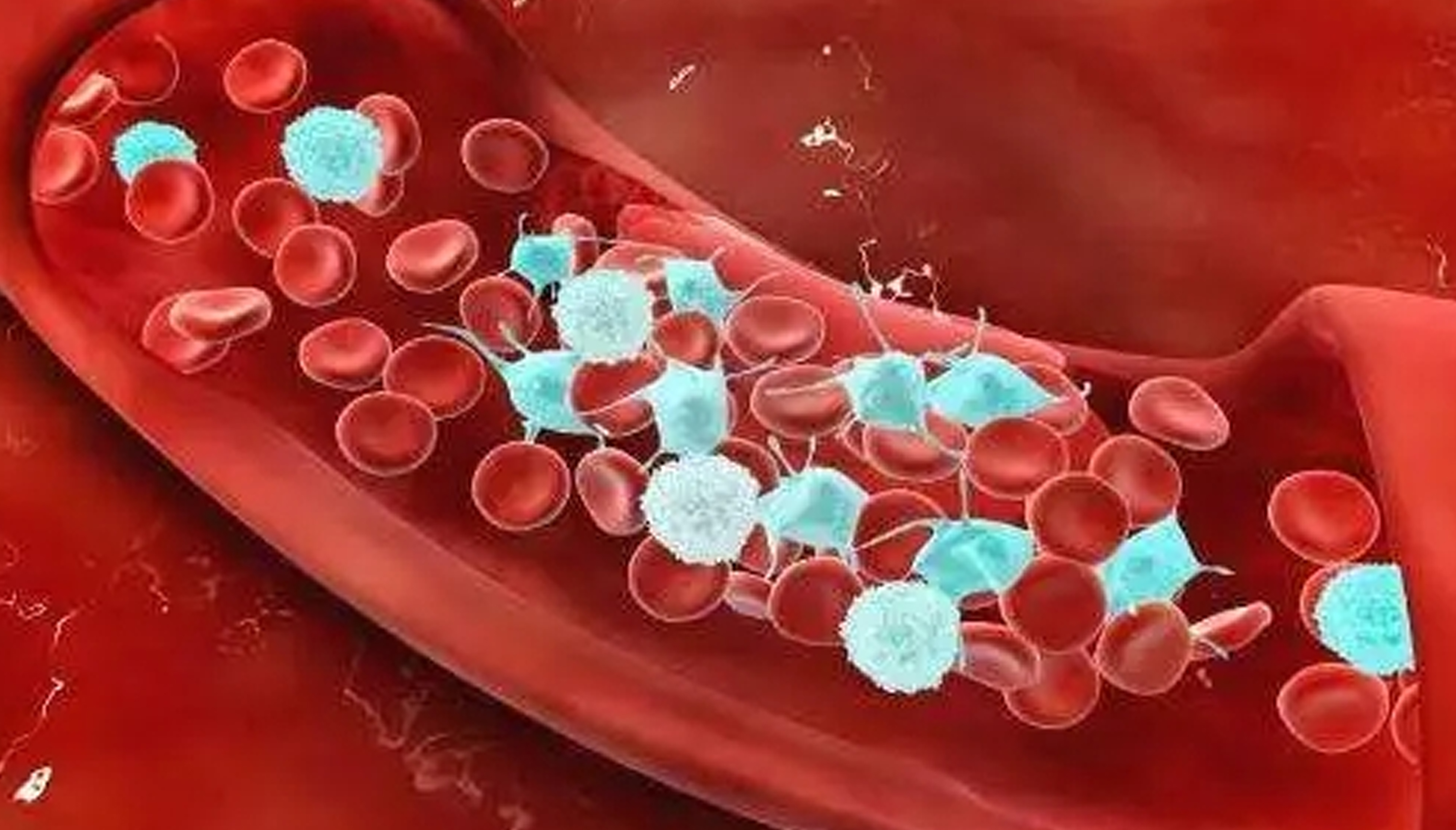 你了解易栓癥嗎?