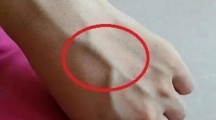 有人手臂上“青筋暴起”，有人卻看不到“青筋”，這是咋回事？