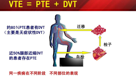 什么是臨床上一致公認(rèn)的VTE防治基礎(chǔ)？
