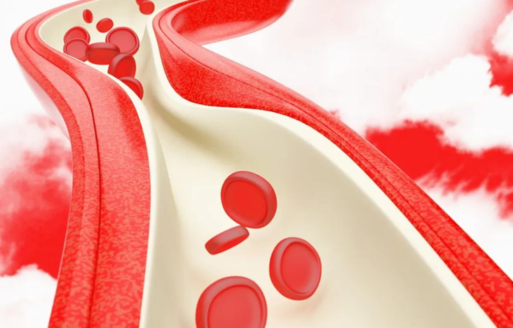 血栓危害大，預(yù)防有辦法