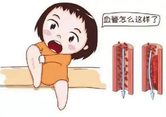 腫瘤不容忽視的第二號(hào)殺手—VTE，該如何防治？