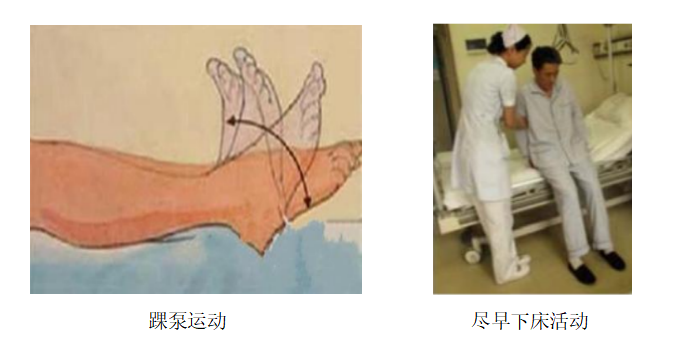 圍術(shù)期患者VTE的預(yù)防，只知道抗凝可不行